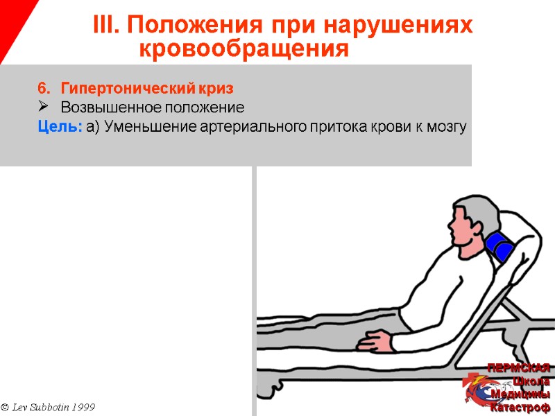 III. Положения при нарушениях   кровообращения © Lev Subbotin 1999